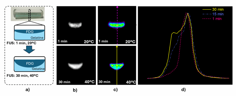 Figura 2. Imágenes reconstruidas de la adquisición simultánea con el inserto PET, la MRI de bajo campo y el sistema FUS. (a) Vista transversal de la composición del fantoma en dos instantes temporales: antes (1 min, 20 °C) y después (30 min, 40 °C) de la aplicación de FUS. (b) Imágenes de MRI del fantoma en esos dos tiempos. (c) Reconstrucciones PET correspondientes a los mismos instantes. (d) Perfiles de actividad extraídos de las imágenes PET a 1, 15 y 30 minutos, mostrando la mezcla del radiotrazador con la gelatina.